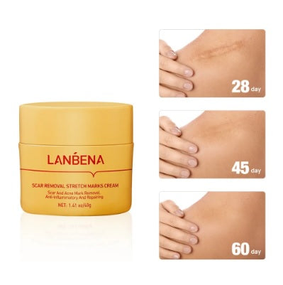 kit to remove scars and stretch marks