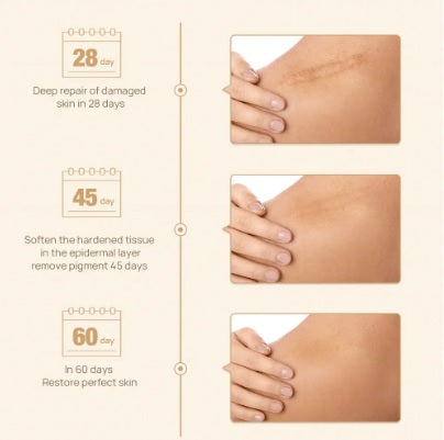 kit to remove scars and stretch marks